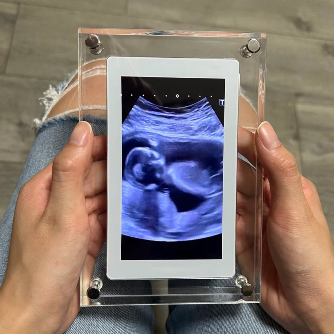 DIGITAL PHOTO FRAME®